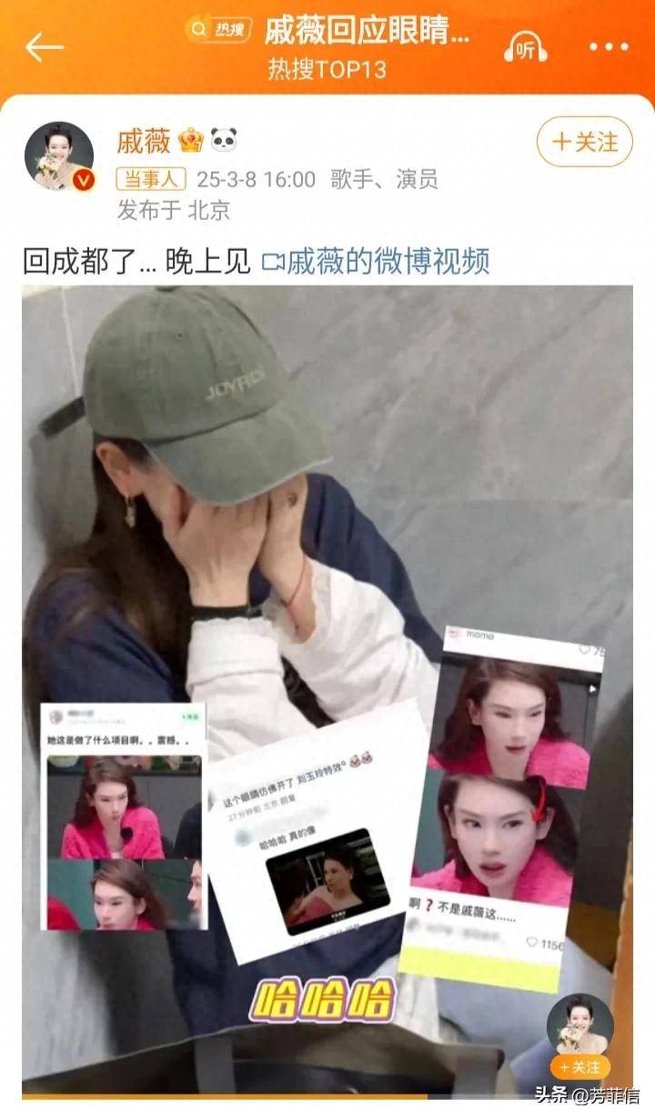 原创            戚薇回应眼睛变样，承认打针，认真分析医美后遗症