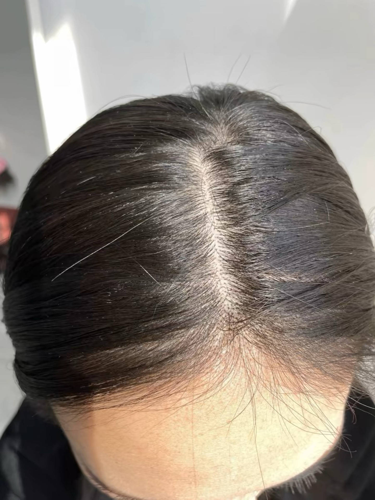 熬夜大学生养发必备！这育发液不下架，我会一直回购！