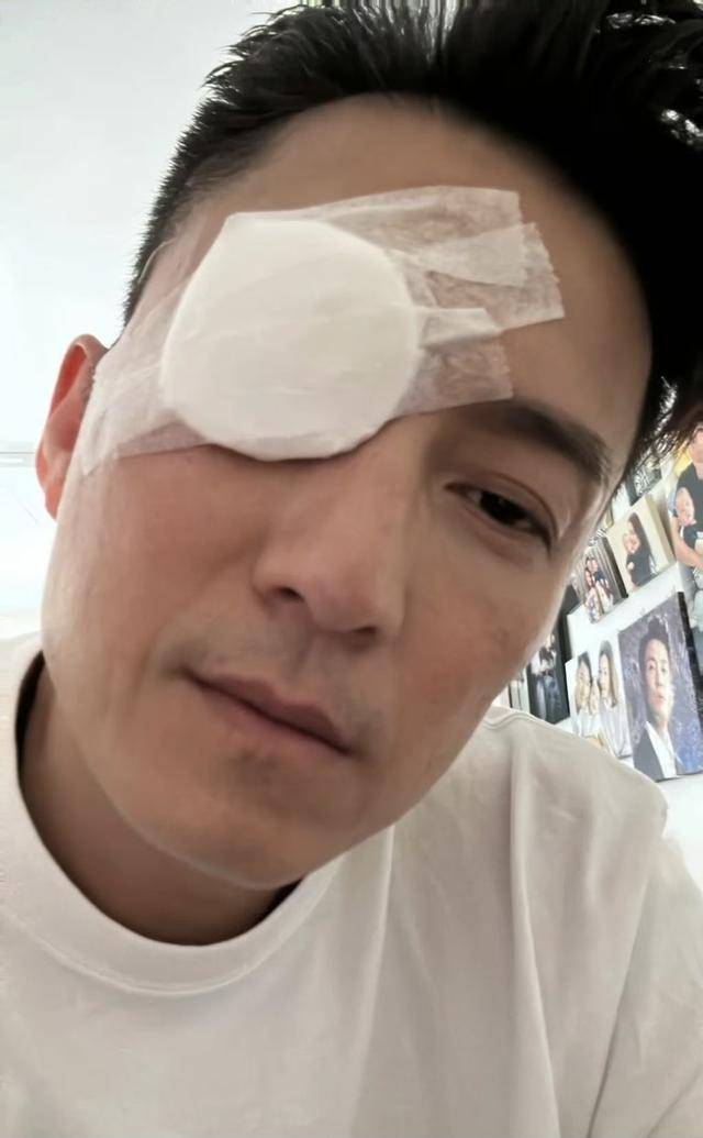 担心！TVB视帝自曝接受眼部手术，一只眼被纱布包裹，状态疲惫