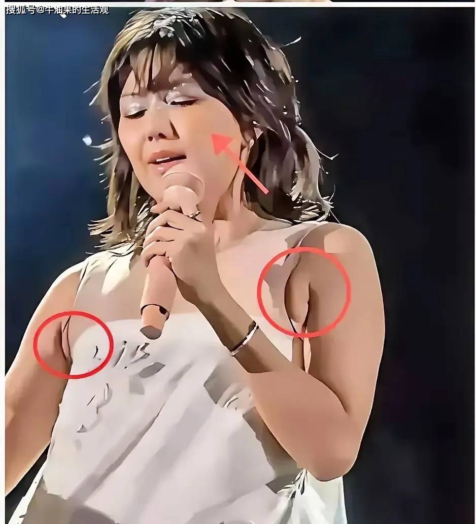 原创            孙燕姿演唱会被吐槽衣品差，膀子太大发福成大妈，脸上皮肤坑坑洼洼