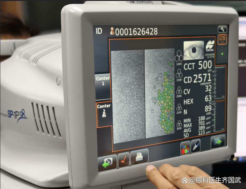 近视手术，为什么要对角膜厚的患者，测量角膜内皮？