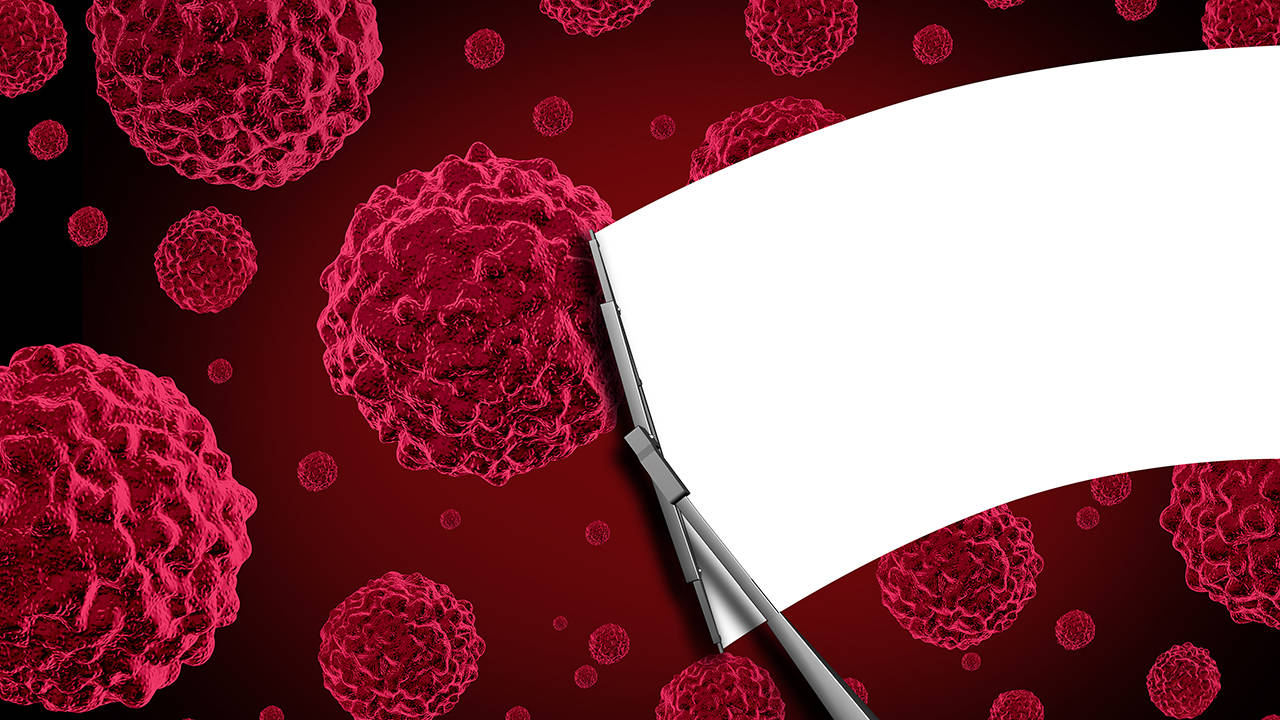 溃疡性结肠癌用中药治疗，能否缓解疼痛？