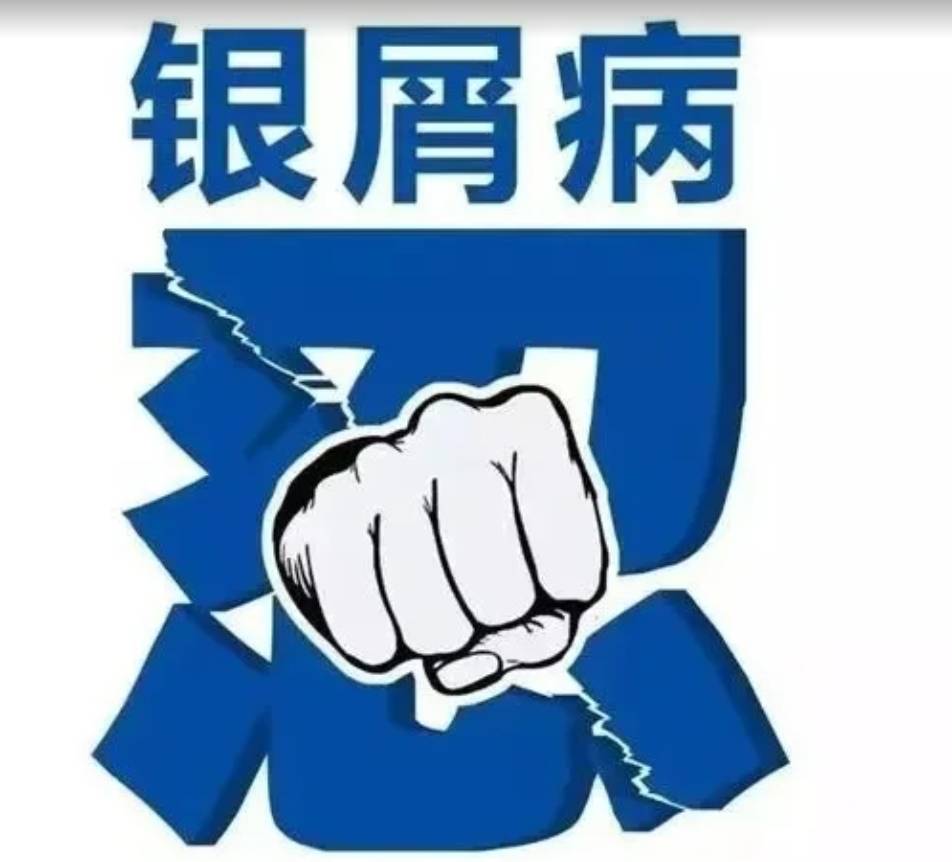 安罗邦细腻柔软，牛皮癣用起来超安心！