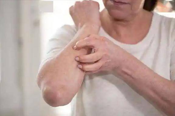 医生调查800名皮肤病患者，惊讶发现：易患皮肤病的人，有5个共性