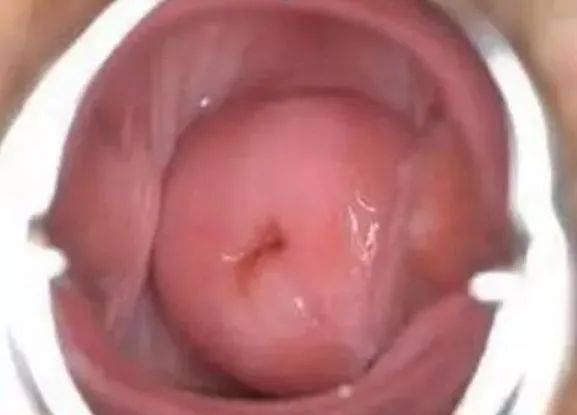 子宫光滑的女人，身上没有4个症状。若你都没有，那子宫真不错！