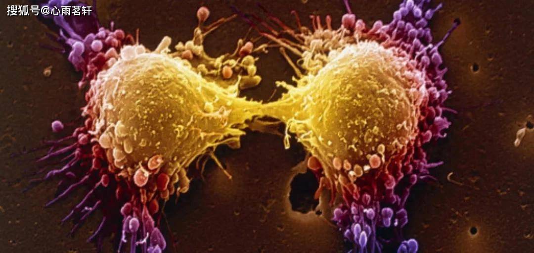 原创            肿瘤的中医治疗：注重胃气，整体观念，固护正气