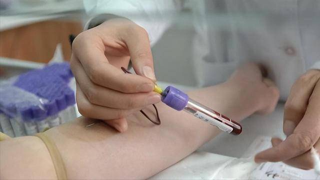 5种“胆固醇大户”被揪出！医生：管不住嘴，吃再多药也没用