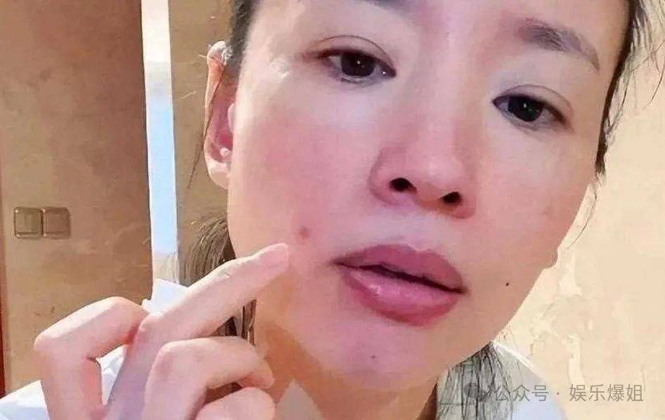 【2025.5.24】艺人和经纪人谁的话语权更大？丁禹兮虞书欣杨紫？白宇和萌萌？陈哲远和梁洁？明星痘痘去除？