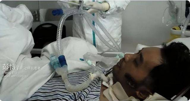 原创            20天4次病危暴瘦40斤，生育功能丧失，首批新冠幸存者怎么样了？