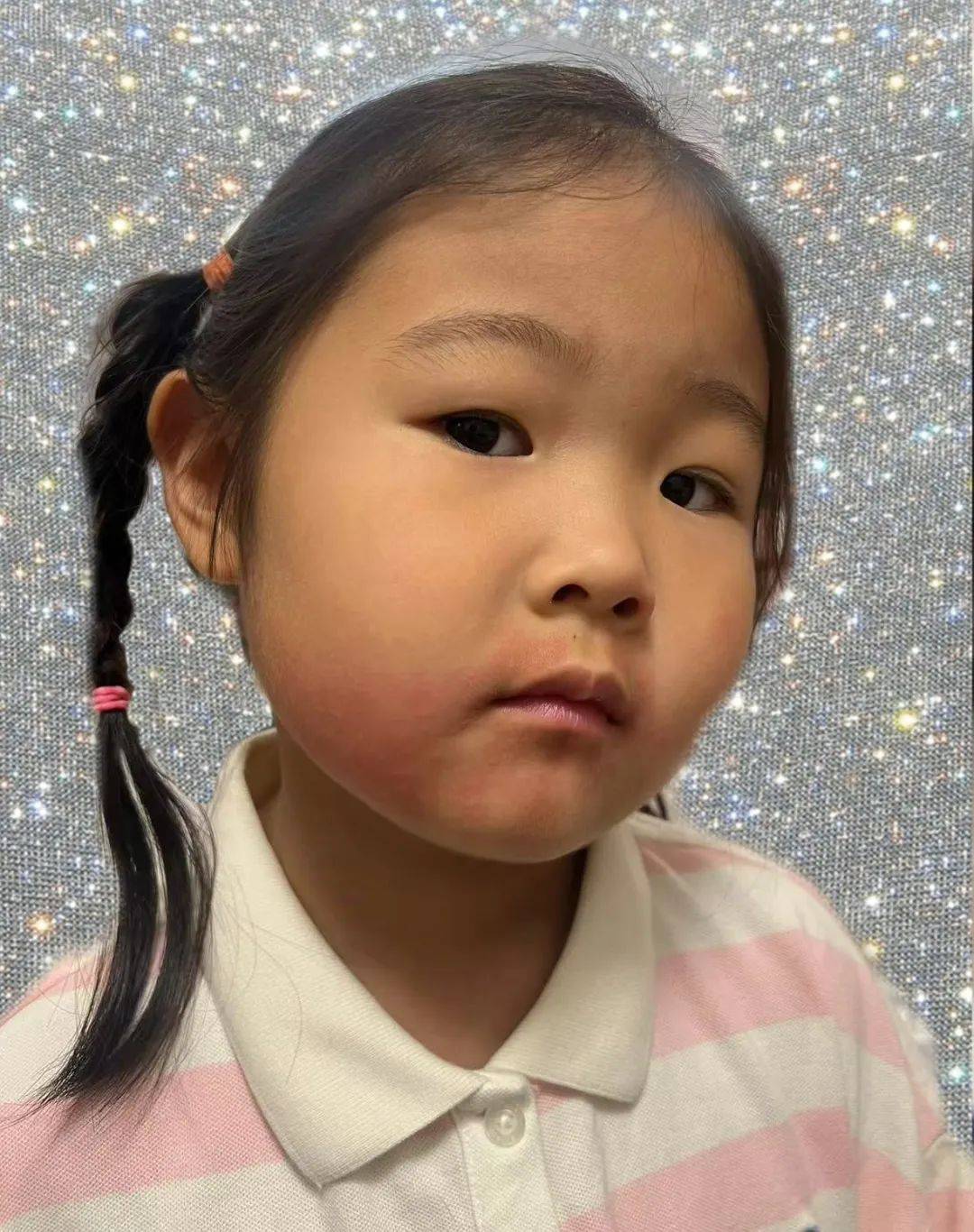 以为正常，其实是孩子过敏的表现，很多家长都不知道