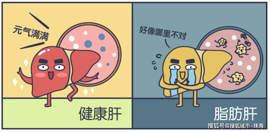 告别肥胖与脂肪肝——中医穴位埋线疗法