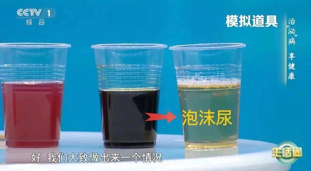 喝水后4个异常，可能是肾发出的“求救信号”