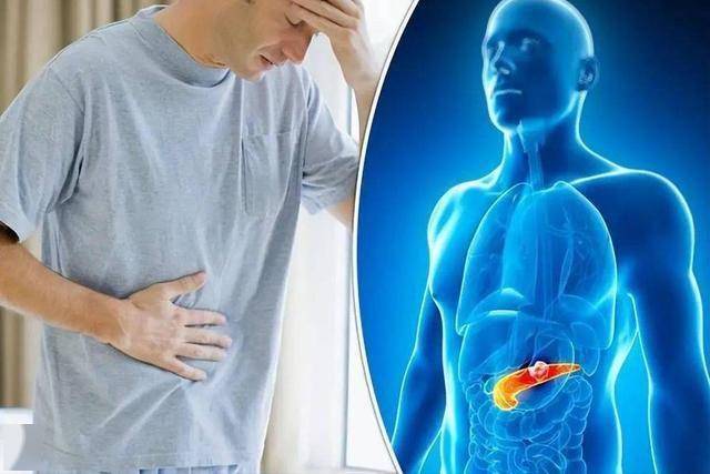 背部是胰腺癌的“反射区”？提醒：3个信号别大意，腹部CT不可少