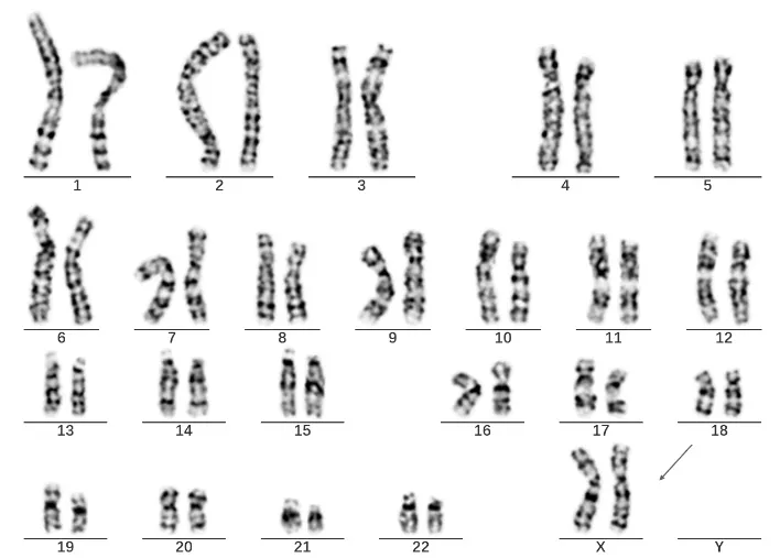 神秘的染色体嵌合现象