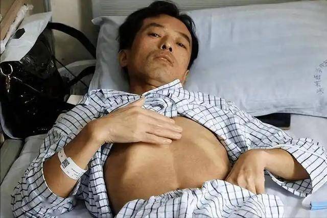 肝癌一到晚期，生命进入倒计时？医生坦白：这3招能延长生存期