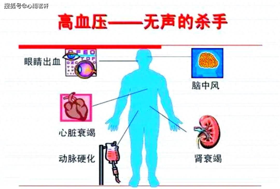 原创            中药真相：枸杞子加桑寄生，血压不高了