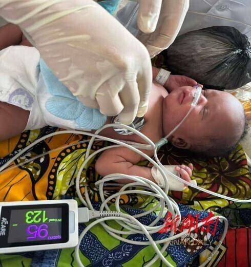 15分钟生死营救：中国援塞医生成功抢救窒息新生儿