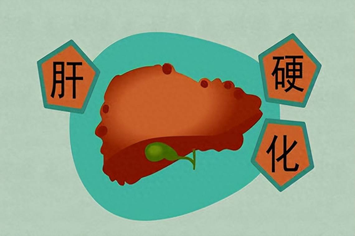 原创            肝硬化不可逆，但可防可控，4类因素易患病，日常管理记住3点