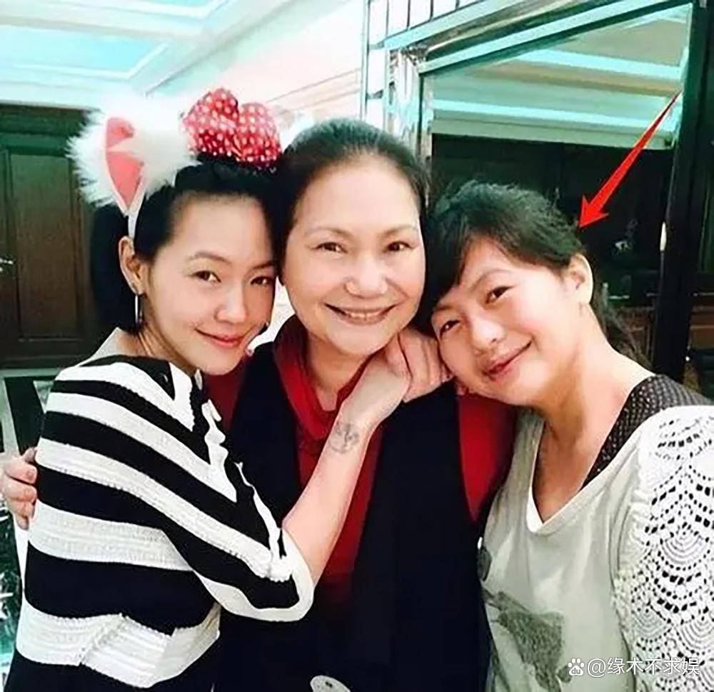 原创            小S婆婆澳门旅游，眼含泪光心情悲痛，眼角淤青疑似受伤！