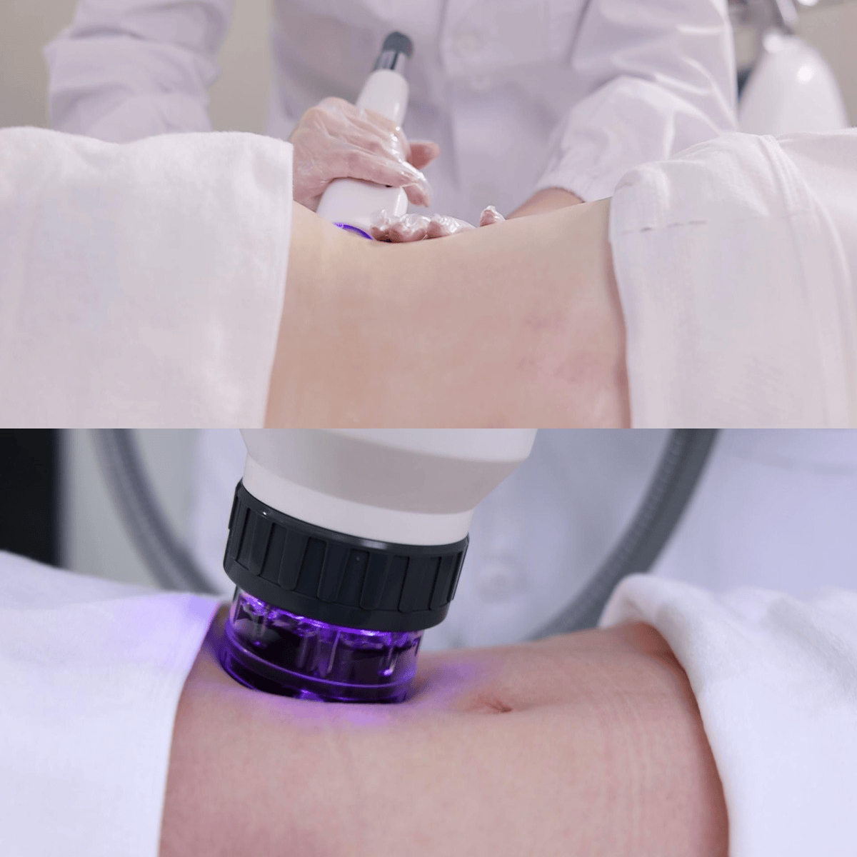 与其与岁月周旋，不如坚持塑形。JordiShape意大利纤体仪