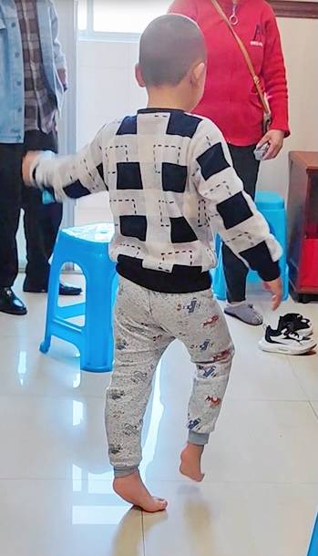 痉挛性脑瘫不再是无解难题，选对方法“自由行走”不是梦