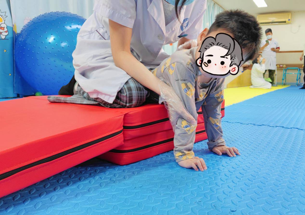 从尖足踮行到平稳行走——SPR术助力脑瘫患儿迈出人生新步伐