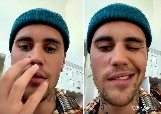 贾斯汀·比伯被曝破产，精神状态堪忧