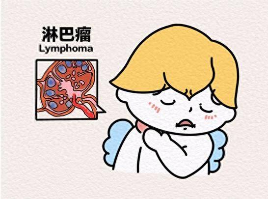 原创            淋巴瘤为何年轻人更易中招？4类因素易患病，4个信号身体在求救