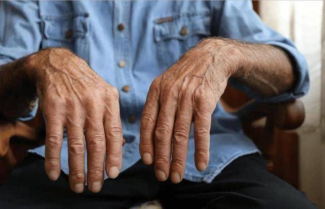 不容易患帕金森的老年人，多半都有这几个习惯，快看看你有几个？