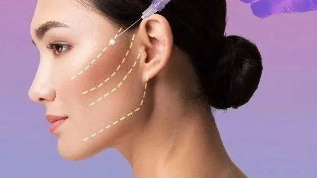 西格洞见：埋植线类医疗器械临床试验设计与操作思路