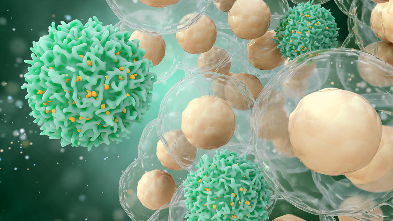 胆管癌复发后腹胀吃什么药？可以缓解吗？