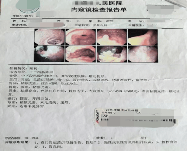 【警惕】男子患癌，胃被切除！这些早期信号一定要注意