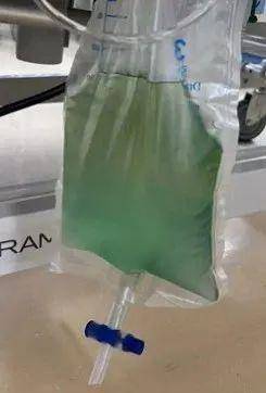 陷入深昏迷！25岁小伙全身青紫，尿液呈“诡异蓝色”！医生：剧毒，0.5克可致命