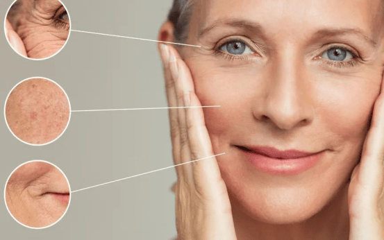 肌肤进入“熟龄”阶段，你是时候该抗老了！