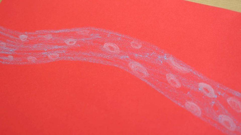 原创            心脑血管、下肢静脉，4处容易形成血栓的位置，劝您要多关注