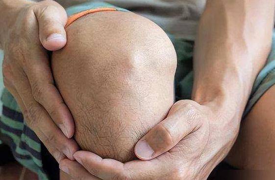 关节增生不难治，老中医分享一个方法，消散痰瘀，缓解肿痛、僵硬