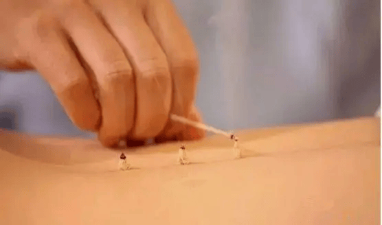 谢锡良：抑郁、失眠，要灸这个穴位！