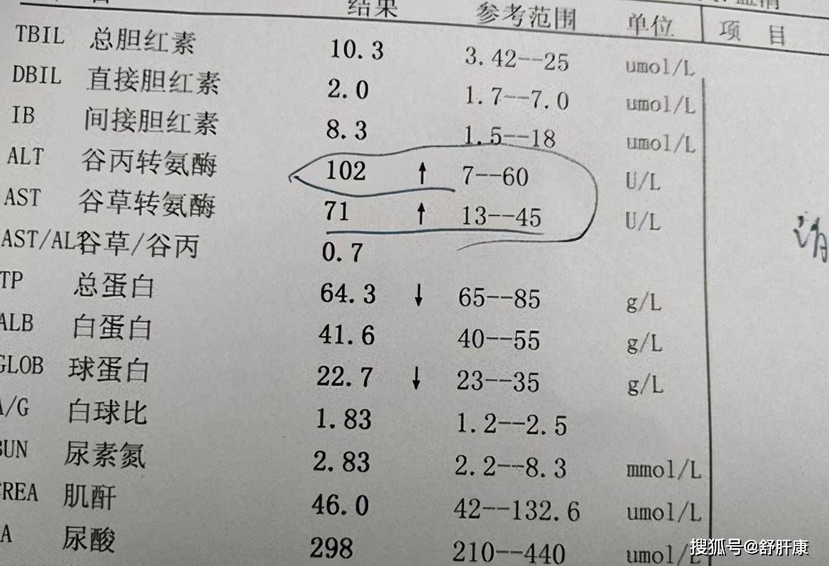 体检发现转氨酶高却没症状，到底要不要治？
