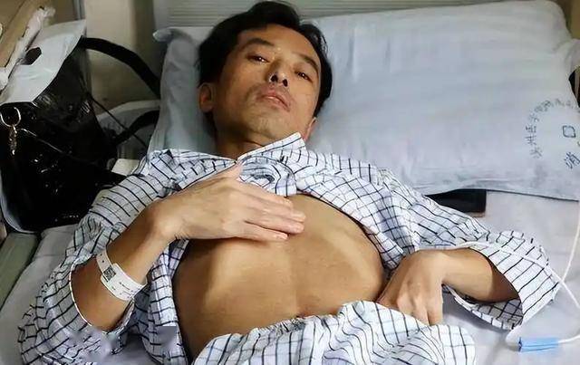 气温升高，医生叮嘱肝病患者：宁可多打麻将，也别随便做这4件事