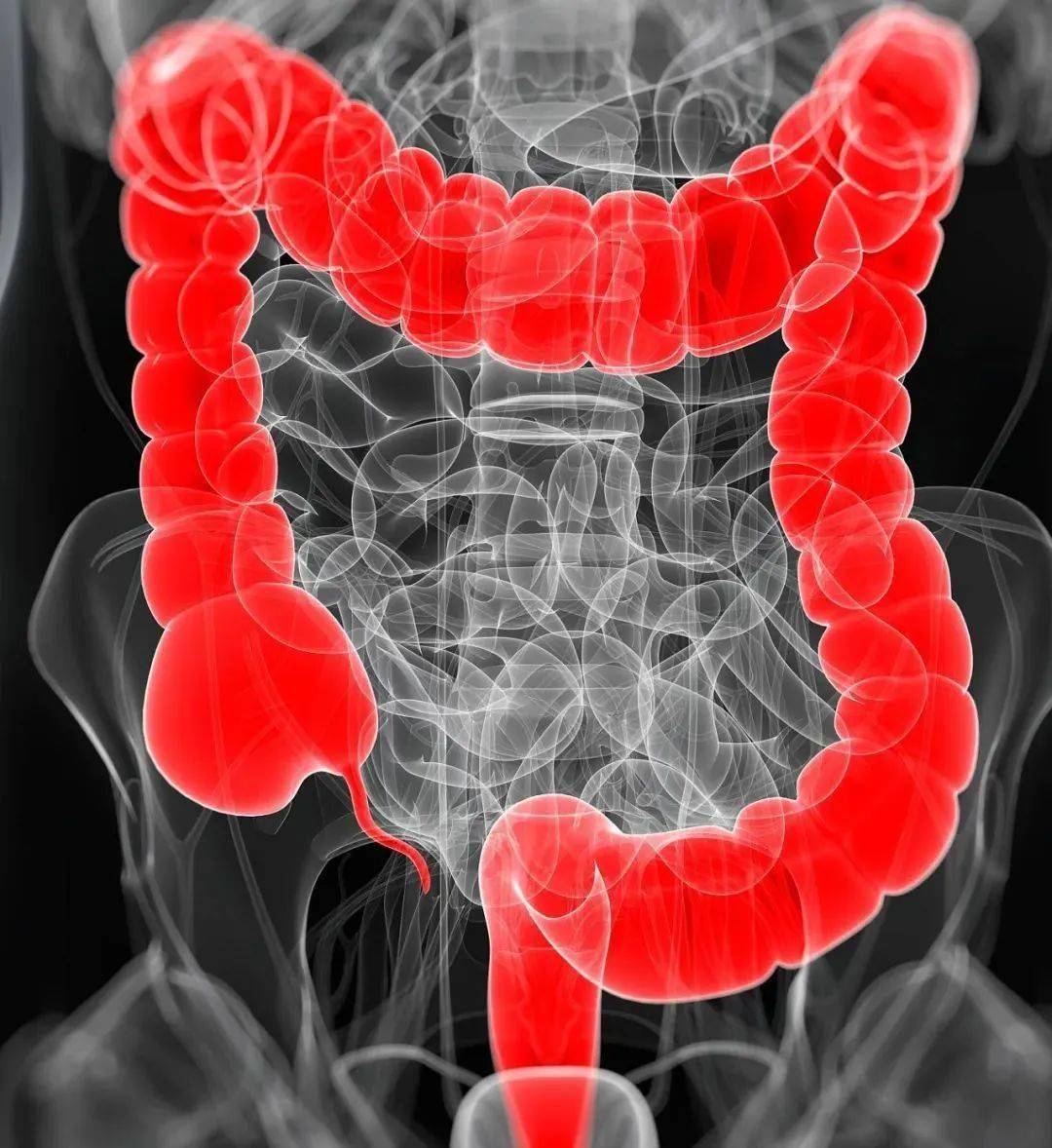 重塑免疫微环境！复旦大学发文：新的结直肠癌免疫治疗策略