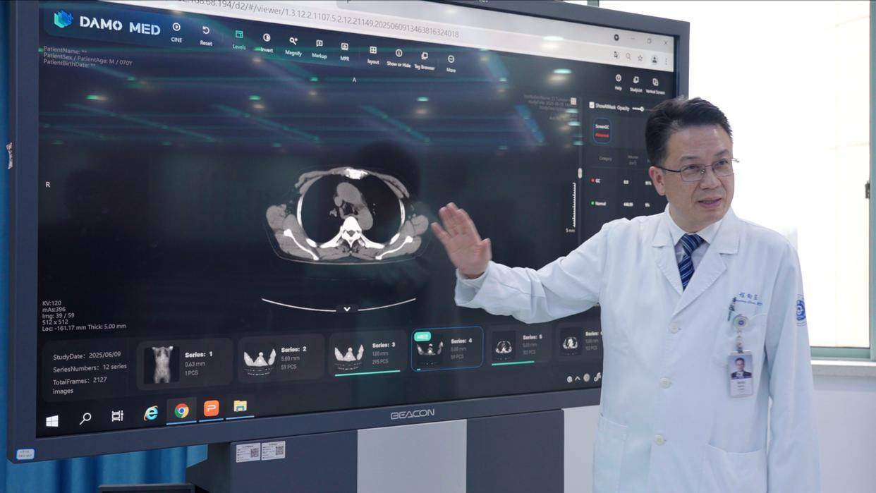 胃癌筛查困局有望破解：AI影像分析推动胃癌早筛智能发展