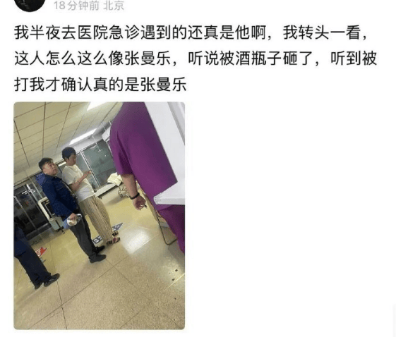 马思纯男友张曼乐现身医院急诊就医 疑似被人用酒瓶砸伤