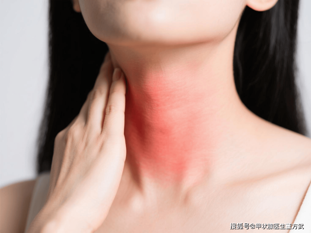 【昆明中研甲状腺医院】甲状腺不好，往往会有5个症状！