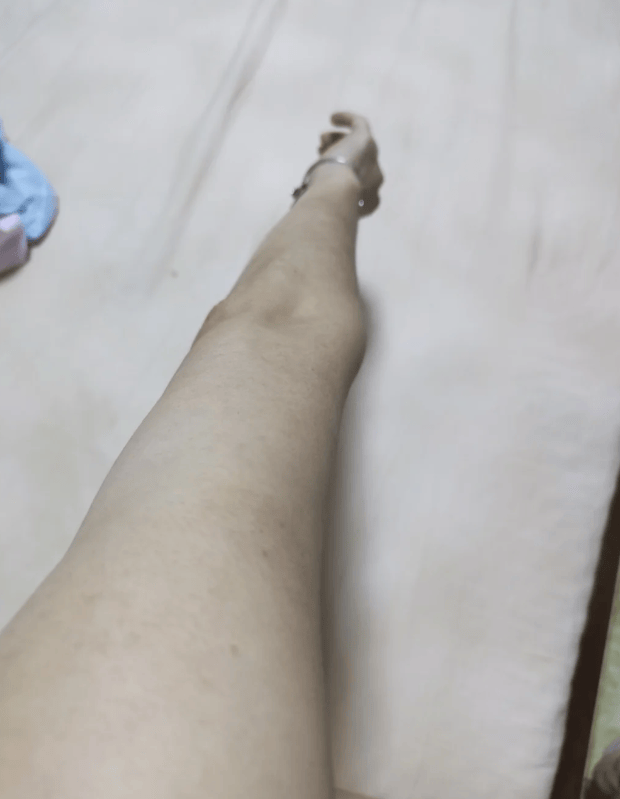 牛皮癣好了，什么都不难了！