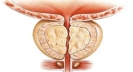 男性健康科普|男性解脲支原体检测方法有哪些？如何治疗？