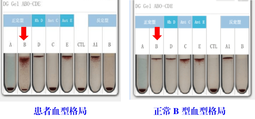 血型“说变就变”？孕妇很疑惑，医生这么说……
