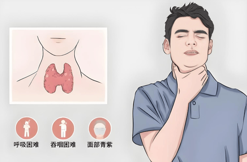 甲状腺癌患者福音：免疫细胞疗法带来新希望