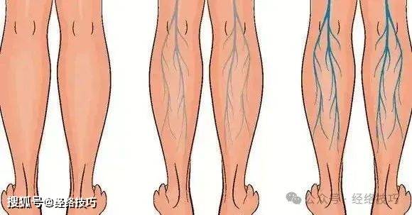 原创            早晚3分钟踮脚呼吸法，助你气血通畅身体好