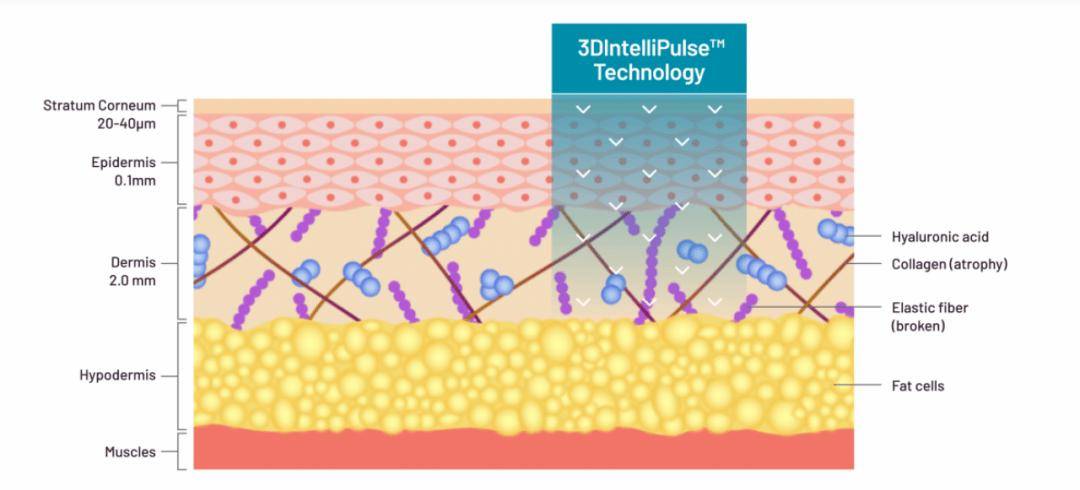 麻省、哈佛教授操刀！Acclaro Medical全球首款2910nm冷激光抗衰设备获批