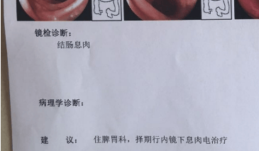 李德昌医生以“一人一方”策略改善肠道健康，智慧化解肠息肉